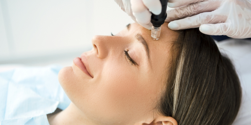 A person with closed eyes lies on a treatment table while a professional wearing gloves applies a skincare device to the person's forehead. The setting, likely in Wake County, suggests a spa or clinic, hinting at facial treatments such as microdermabrasion or chemical peels in progress.
