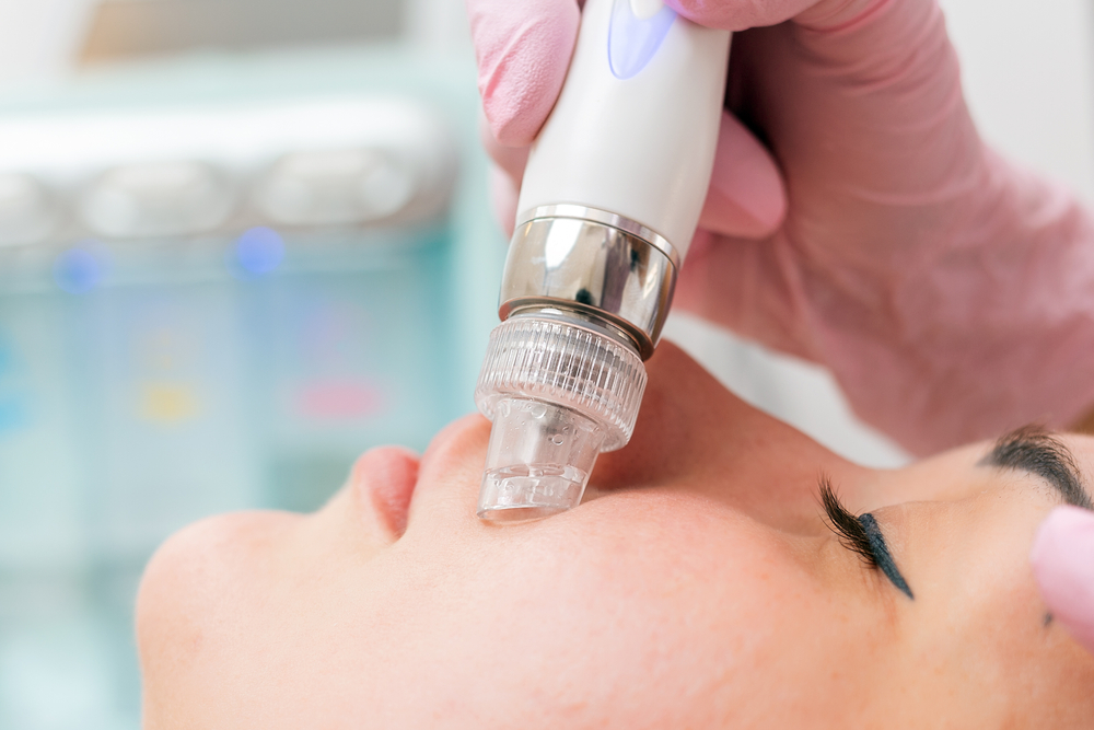 A person receives a facial treatment with a hydrodermabrasion machine. A gloved hand holds the device, applying it to the person's cheek. The background is blurred, indicating a clinical setting in Wake County. The person has closed eyes and appears relaxed during the hydra facial procedure.