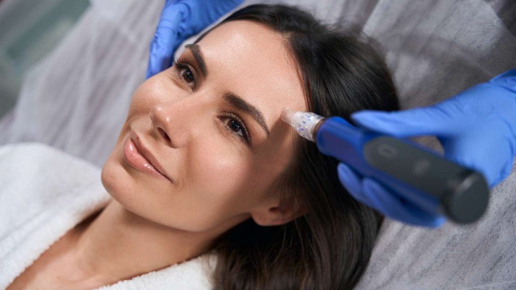 A woman with dark hair lies on a treatment bed while a person in blue gloves uses a microneedling device on her forehead. She has a calm expression and is wearing a white robe, enjoying one of the premier skincare treatments offered alongside Chemical Peels in Wake County.