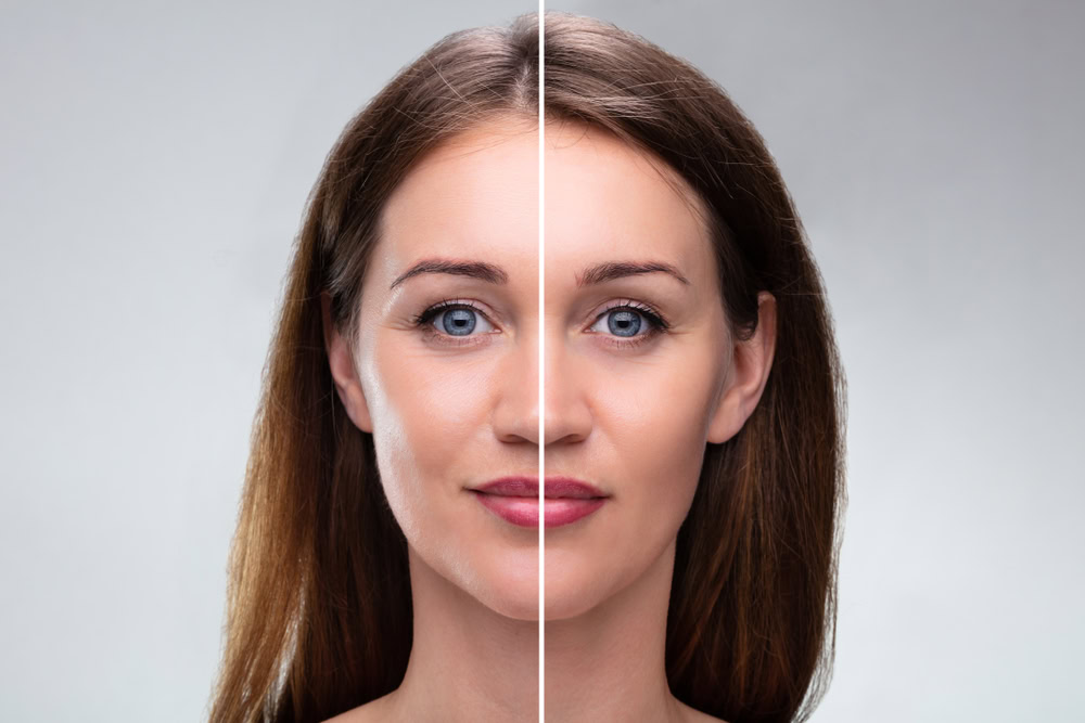 A woman's face divided vertically; one side shows natural skin, while the other side appears digitally enhanced or altered, illustrating a before-and-after contrast in appearance.