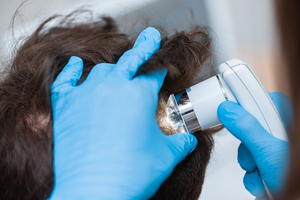 A person wearing blue gloves examines another person's scalp using a handheld microscope.