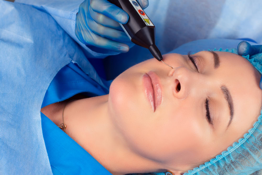 A woman lies with her eyes closed while a medical professional in blue gloves uses a handheld laser device on her face near the nose, likely performing a cosmetic skin procedure.